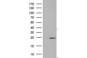 HEK293T cells were transfected with the pCMV6-ENTRY control (Left lane) or pCMV6-ENTRY MOBKL2B (Right lane) cDNA for 48 hrs and lysed. (MOBKL2B 抗体)