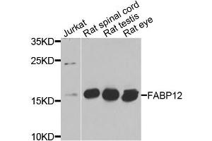 Western blot analysis of extracts of various cells, using FABP12 antibody. (FABP12 抗体)