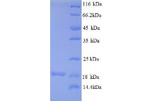 MRPL54 Protein (AA 15-138) (His tag)