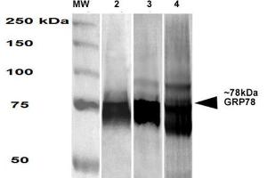 Western Blot analysis of Human, Mouse, Rat HEK-293, NIH3T3, and Rat Brain cell lysates showing detection of GRP78 protein using Mouse Anti-GRP78 Monoclonal Antibody, Clone 3G12-1G11 . (GRP78 抗体  (HRP))