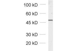 dilution: 1 : 1000, sample: total cell lysate from fibroblasts transfected with a GFP fusion construct (GFP 抗体)