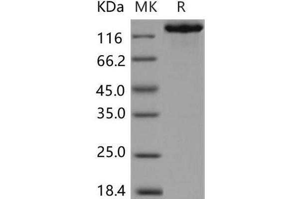 DDX11 Protein (Fc Tag)