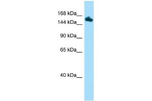 Host:  Rabbit  Target Name:  Setd5  Sample Type:  Mouse Stomach lysates  Antibody Dilution:  1. (SETD5 抗体  (C-Term))