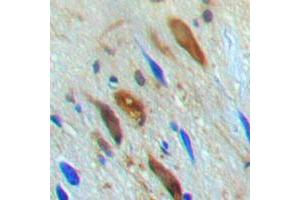 Immunohistochemical analysis of SMAD3 (pT179) staining in human brain formalin fixed paraffin embedded tissue section. (SMAD3 抗体  (pSer179))