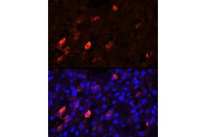 Immunofluorescence analysis of Human adrenal gland cells using PENK Rabbit pAb (ABIN6133151, ABIN6145444, ABIN6145445 and ABIN6221906) at dilution of 1:25 (40x lens). (Enkephalin 抗体  (AA 25-267))