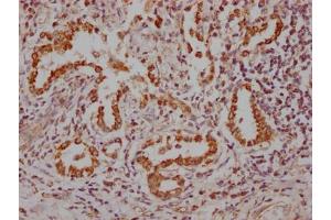 Immunohistochemistry (IHC) image for anti-NK2 Homeobox 1 (NKX2-1) antibody (ABIN7127859)