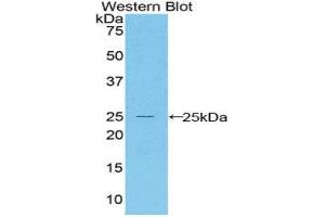 Western Blotting (WB) image for anti-BCL2-Associated X Protein (BAX) (AA 1-158) antibody (ABIN1858117) (BAX 抗体  (AA 1-158))