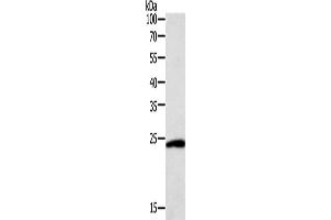 Western Blotting (WB) image for anti-Synaptosomal-Associated Protein, 25kDa (SNAP25) antibody (ABIN2422165) (SNAP25 抗体)