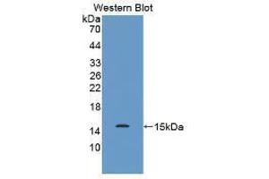 Western blot analysis of the recombinant protein. (MUC2 抗体  (AA 5075-5179))