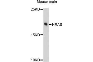 Western blot analysis of extracts of mouse brain, using HRAS Antibody (ABIN5997928) at 1:3000 dilution. (HRAS 抗体)