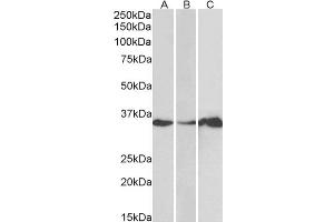 Western Blotting (WB) image for anti-LIM and SH3 Protein 1 (LASP1) antibody (ABIN5921969) (LASP1 抗体)