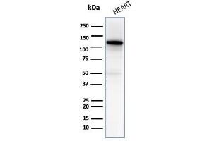 Western blot analysis of Heart tissue lysate using N-Cadherin Mouse Monoclonal Antibody (13A9). (N-Cadherin 抗体  (Cytoplasmic Domain))