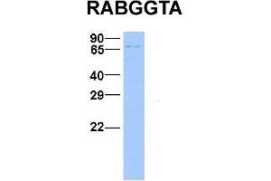 Host:  Rabbit  Target Name:  RABGGTA  Sample Type:  Hela  Antibody Dilution:  1. (RABGGTA 抗体  (N-Term))