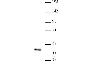 ATF1 antibody (pAb) tested by Western blot. (AFT1 抗体  (C-Term))
