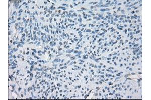Immunohistochemical staining of paraffin-embedded endometrium tissue using anti-FCGR2A mouse monoclonal antibody. (FCGR2A 抗体)