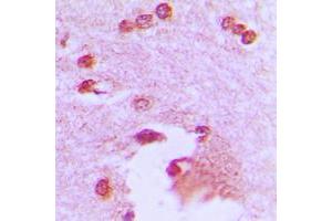 Immunohistochemical analysis of APBA2 staining in human brain formalin fixed paraffin embedded tissue section. (APBA2 抗体  (Center))