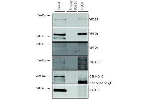 Immunoprecipitation analysis using Mouse Anti-VPS35 Monoclonal Antibody, Clone 10A8 (ABIN6933001). (VPS35 抗体  (PerCP))