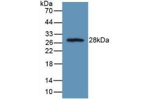 Western blot analysis of recombinant Rat FGFRL1. (FGFRL1 抗体  (AA 164-368))