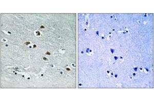 Immunohistochemistry analysis of paraffin-embedded human brain tissue, using HDAC6 (Ab-22) Antibody. (HDAC6 抗体  (AA 7-56))