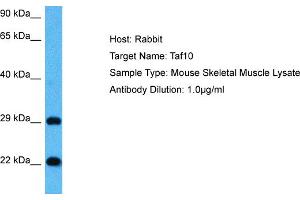 Host: Mouse Target Name: TAF10 Sample Tissue: Mouse Skeletal Muscle Antibody Dilution: 1ug/ml (TAF10 抗体  (Middle Region))