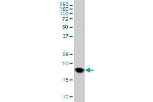 Western Blotting (WB) image for anti-Ubiquitin-Conjugating Enzyme E2C (UBE2C) (AA 70-179) antibody (ABIN564800)