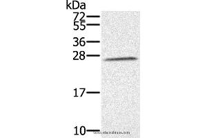 Western blot analysis of K562 cell, using SSX1 Polyclonal Antibody at dilution of 1:350 (SSX1 抗体)