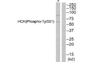 Western blot analysis of extracts from JurKat cells, using HCK (Phospho-Tyr521) antibody. (HCK 抗体  (pTyr521))