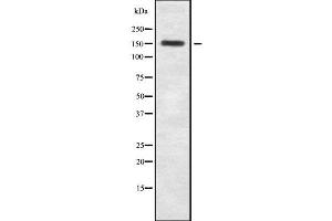 Western blot analysis of Tensin-2 using MCF7 whole cell lysates (TENC1 抗体  (Internal Region))