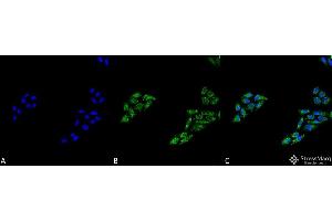 Immunocytochemistry/Immunofluorescence analysis using Rabbit Anti-p53 Polyclonal Antibody . (p53 抗体  (C-Term) (HRP))