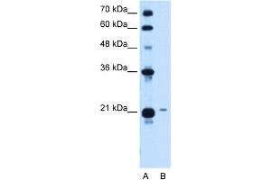 WB Suggested Anti-TCP10L Antibody Titration:  1. (TCP10L 抗体  (Middle Region))