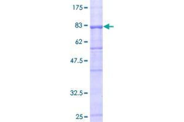 UGT1A10 Protein (AA 1-530) (GST tag)