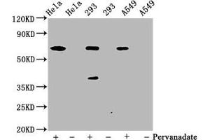 Western Blot Positive WB detected in Hela whole cell lysate ? (Recombinant PTPN11 抗体  (pTyr542))