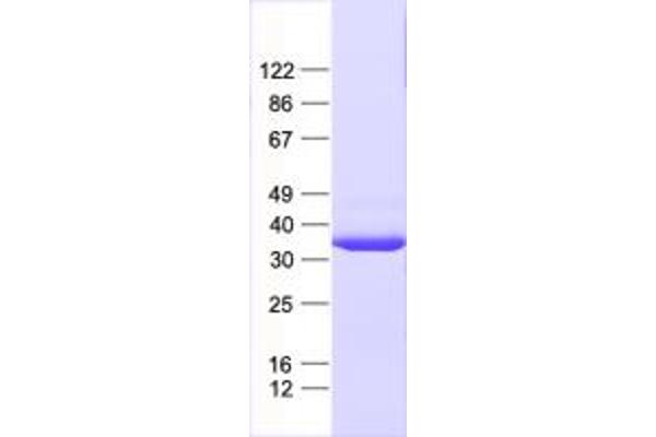 C20orf7 Protein (His tag)