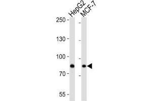 Western Blotting (WB) image for anti-Ubiquitin Specific Peptidase 51 (USP51) antibody (ABIN3004645) (USP51 抗体)