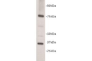 Western Blotting (WB) image for anti-Interleukin 7 Receptor (IL7R) (N-Term) antibody (ABIN1854927) (IL7R 抗体  (N-Term))