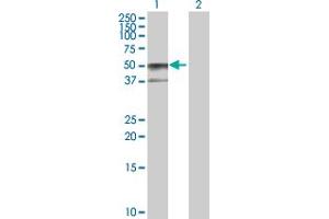 Western Blot analysis of SERPINA6 expression in transfected 293T cell line by SERPINA6 MaxPab polyclonal antibody. (SERPINA6 抗体  (AA 1-405))