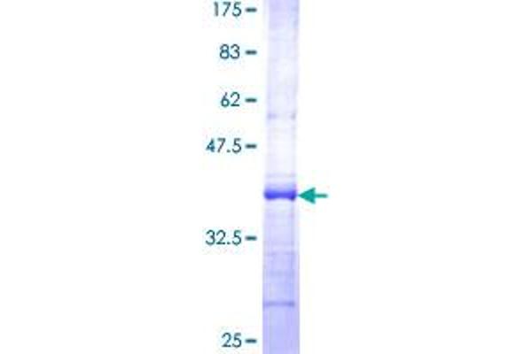 EIF1AY Protein (AA 31-120) (GST tag)