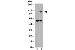 Western blot of HEK293 lysate overexpressing IDE probed with IDE antibody (mock transfection in lane 1). (IDE 抗体)