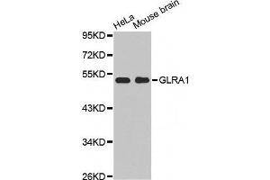 Western Blotting (WB) image for anti-Glycine Receptor, alpha 1 (GLRA1) (AA 29-247) antibody (ABIN6219938) (GLRA1 抗体  (AA 29-247))