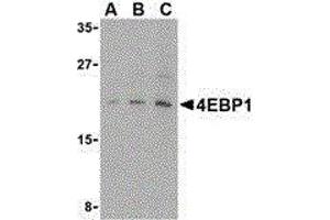 Western Blotting (WB) image for anti-Eukaryotic Translation Initiation Factor 4E Binding Protein 1 (EIF4EBP1) (C-Term) antibody (ABIN2477208) (eIF4EBP1 抗体  (C-Term))