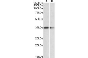 ABIN2564722 (2µg/ml) staining of Mouse (A) and Rat (B) Brain lysates (35µg protein in RIPA buffer). (PRMT2 抗体  (Internal Region))