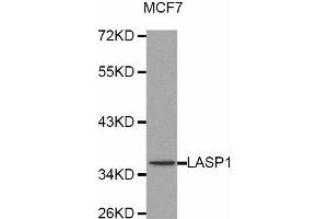 Western Blotting (WB) image for anti-LIM and SH3 Protein 1 (LASP1) antibody (ABIN1873516) (LASP1 抗体)