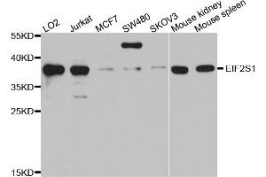 Western blot analysis of extracts of various cell lines, using EIF2S1 antibody (ABIN5970287) at 1/1000 dilution. (EIF2A 抗体)