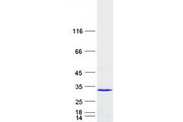 RAB14 Protein (Myc-DYKDDDDK Tag)