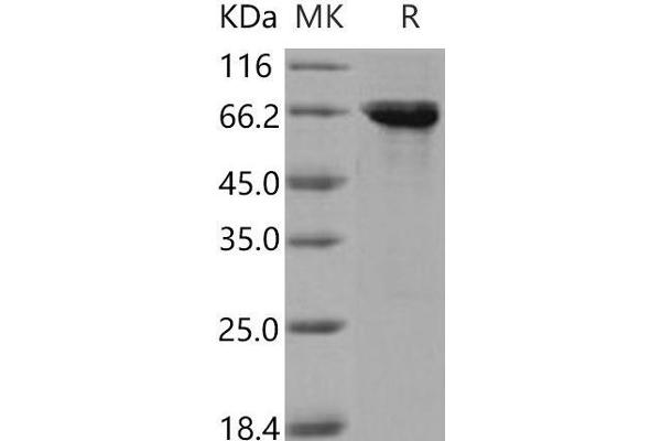 STK26/MST4 Protein (GST tag)