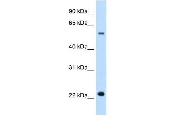 Solute Carrier Family 17 (Acidic Sugar Transporter), Member 5 (SLC17A5) 抗体