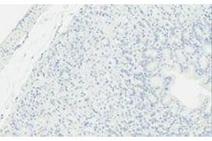 Immunohistochemistry (IHC) image for anti-TLR4 /MD2 Complex antibody (ABIN2665420) (TLR4 /MD2 Complex 抗体)