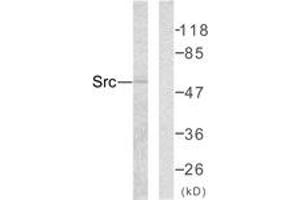 Western Blotting (WB) image for anti-Proto-oncogene tyrosine-protein kinase Src (Src) (AA 386-435) antibody (ABIN2889066) (Src 抗体  (AA 386-435))