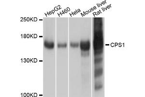 Western blot analysis of extracts of various cell lines, using CPS1 antibody. (CPS1 抗体)