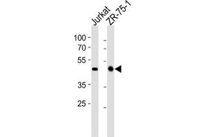 Western Blotting (WB) image for anti-ECSIT (ECSIT) antibody (ABIN2998295) (ECSIT 抗体)